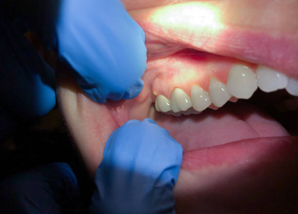 Dentist for Dental Trauma in NY